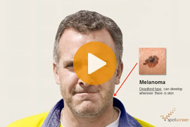 prevent-skin-cancer-business-spotscreen-video-help