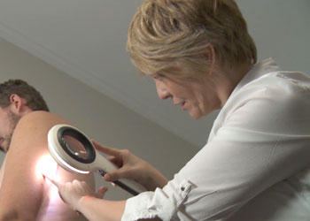 Spotscreen practitioner performs a skin cancer screening