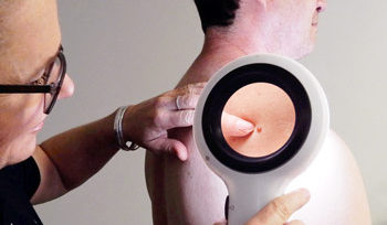 Spotscreen practitioner checking skin