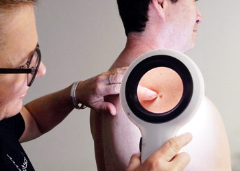 Spotscreen practitioner checking skin